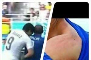 Il morso di Suarez a Chiellini